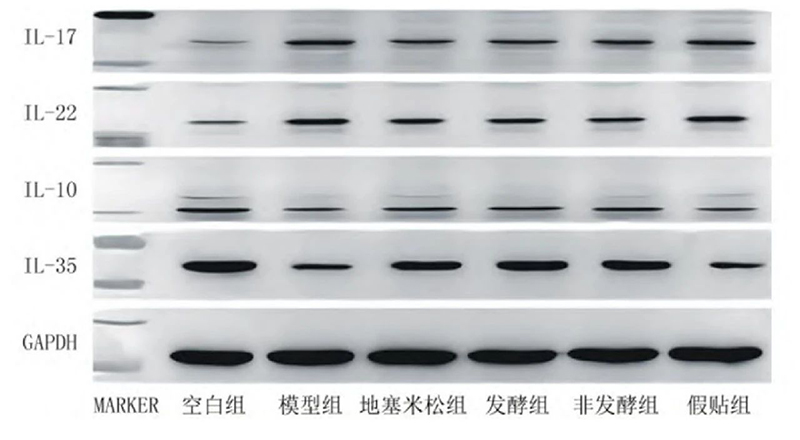 空白组和支气管哮喘各组大鼠肺组织中IL－17、IL－22、IL－10、IL－35蛋白表达电泳图